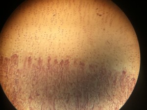 Ossification - Proliferative zone with chondrocytes stacking up Ossification - Proliferative zone with chondrocytes stacking up