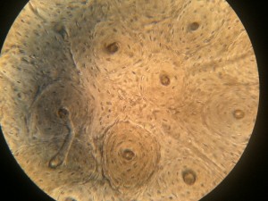 Osteons in Compact Bone Histology