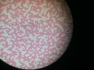 Horse blood smear with erythrocytes