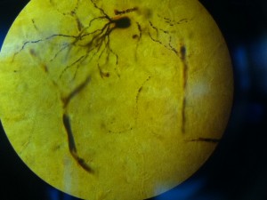Histology astrocyte nerve cell