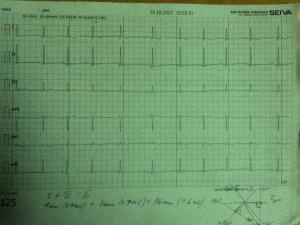 Heart physiology dog ecg vet school diary